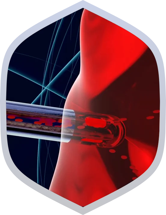 The Tumor Monorail guiding tumor cells along its scaffold